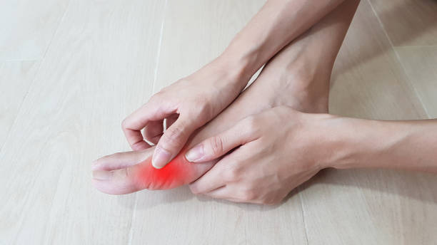 Could Foot Regeneration Be Your Secret Weapon Against Chronic Gout Pain?